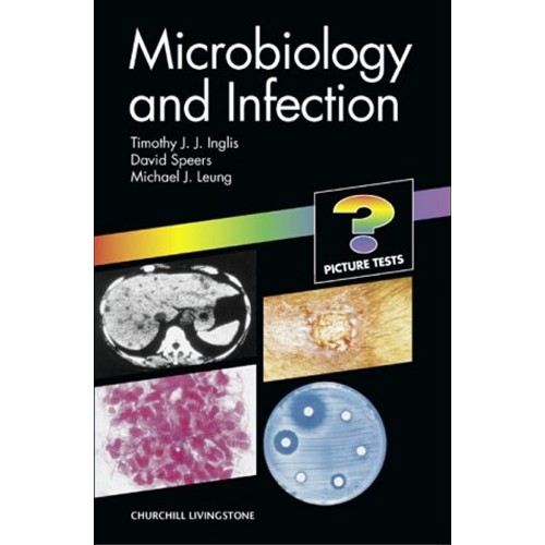 Microbiology And Infection 