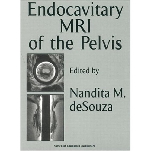 Endocavitary Mri Of The Pelvis 