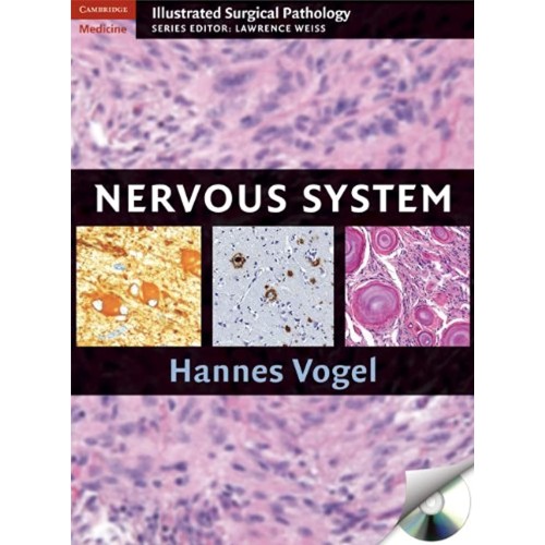 Nervous System (Hb 2009)