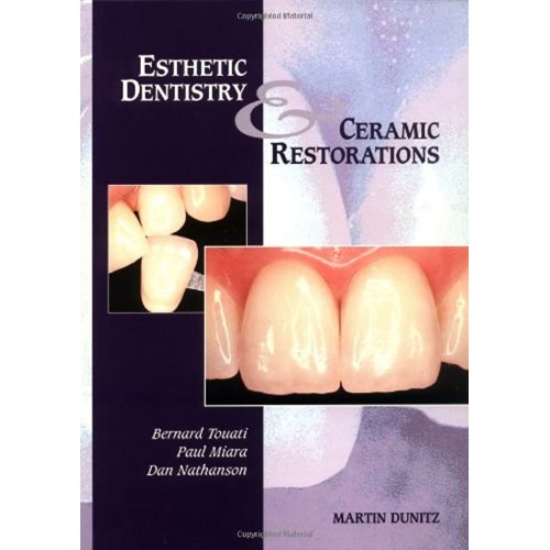 Esthetic Dentistry & Ceramic Restorations 