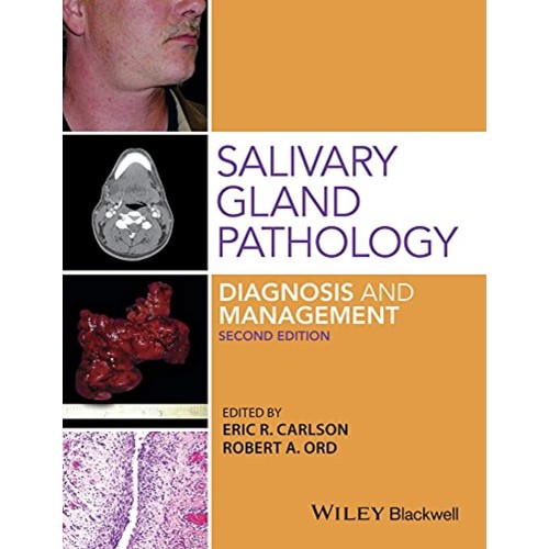 Salivary Gland Pathology Diagnosis And Manage...