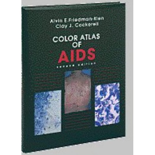 Color Atlas Of Aids : 2 /E 