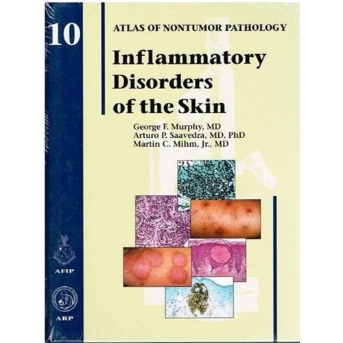 Inflammatory Disorders Of The Skin Nontumor P...