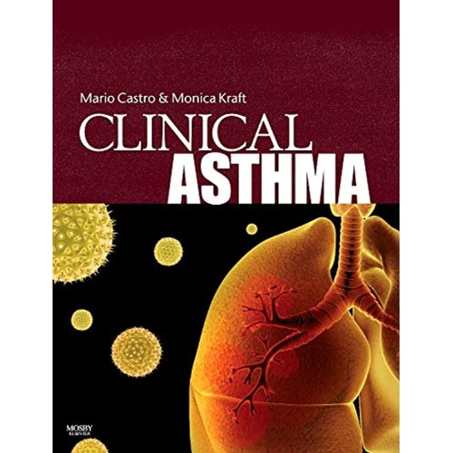 Clinical Asthma: Expert Consult - Online And ...