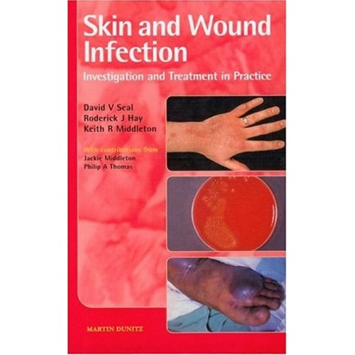 Skin And Wound Infection: Investigation And T...