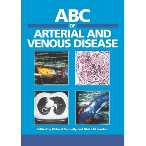 Abc Of Arterial And Venous Disease 