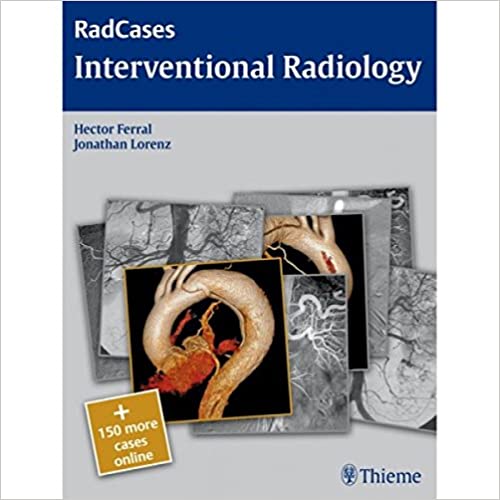 Radcases: Interventional Radiology (Ie) 