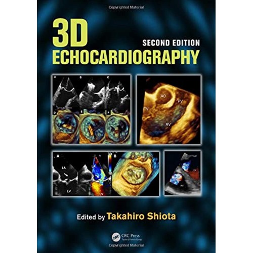 3D Echocardiography 2Ed (Hb 2014) 