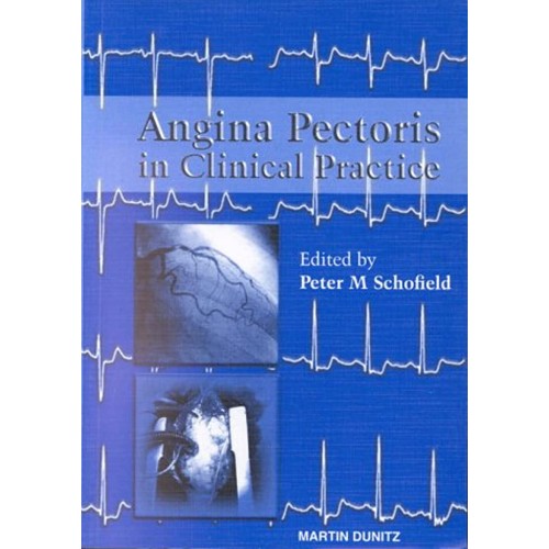 Angina Pectoris In Clinical Practice 