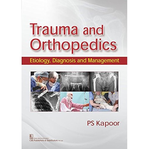 Trauma And Orthopedics Etiology Diagnosis And...