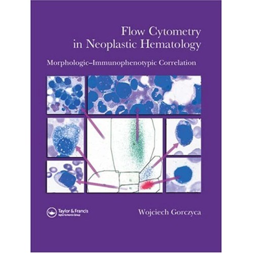 Flow Cytometry In Neoplastic Hematology: Morp...