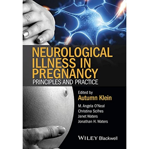 Neurological Illness In Pregnancy Principles ...