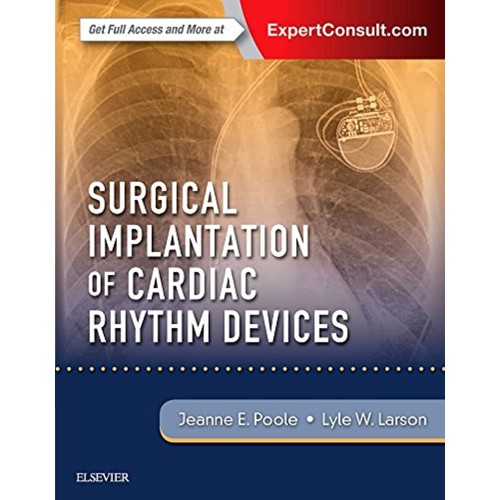 Surgical Implantation Of Cardiac Rhythm Devic...