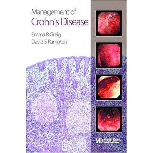 Management Of Crohn'S Disease 