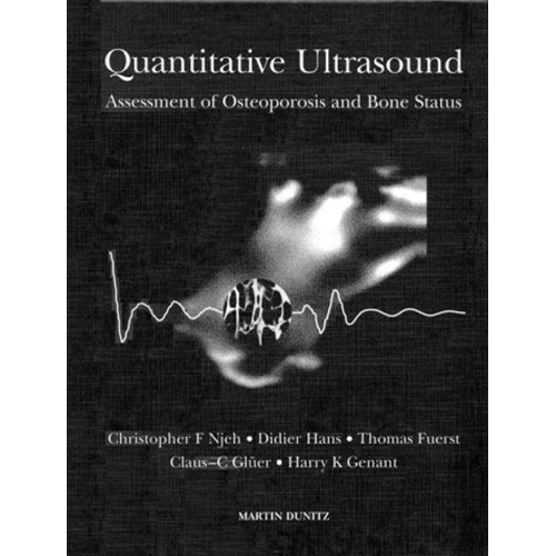 Quantitive Ultrasound: Assessment Of Osteopor...