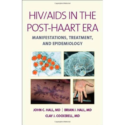 Hiv Aids In The Post Haart Era Manifestations...