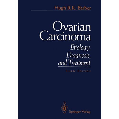 Ovarian Carcinoma Etiology Diagnosis And Trea...