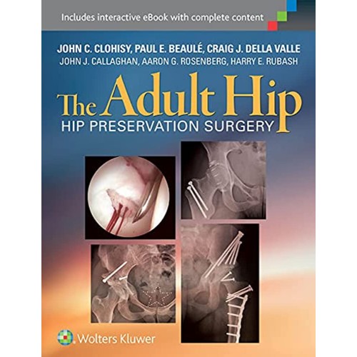 The Adult Hip Hip Preservation Surgery (Hb 20...