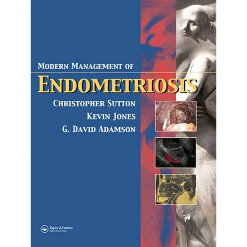 Modern Management Of Endometriosis 