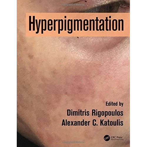 Hyperpigmentation (Hb 2018) 