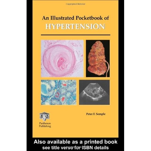 An Illustrated Pocketbook Of Hypertension 