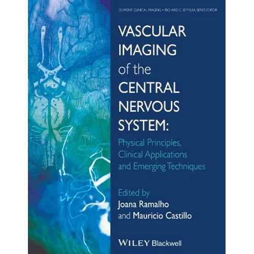 Vascular Imaging Of The Central Nervous Syste...