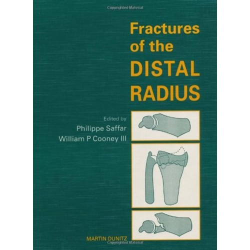 Fractures Of The Distal Radius 