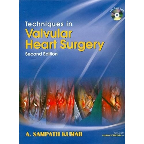 Techniques In Valvular Heart Surgery 2Ed (Wit...