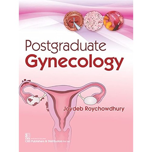 Postgraduate Gynecology (Pb 2017) 