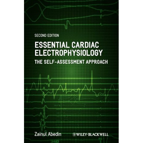 Essential Cardiac Electrophysiology 2Ed: The ...