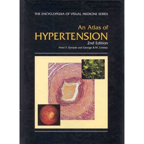 An Atlas Of Hypertension (Encyclopedia Of Vis...