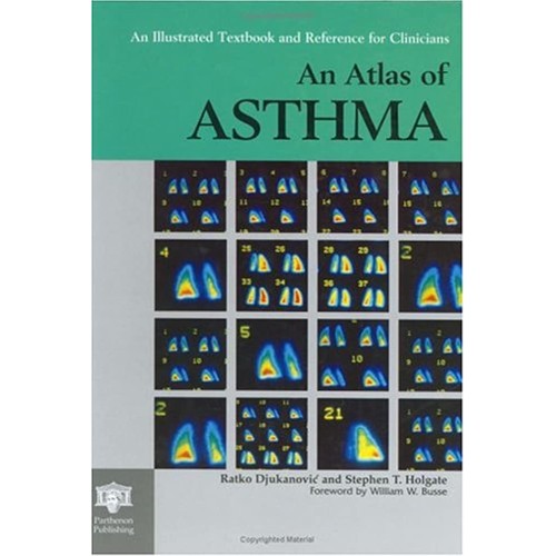 An Atlas Of Asthma (Encyclopedia Of Visual Me...