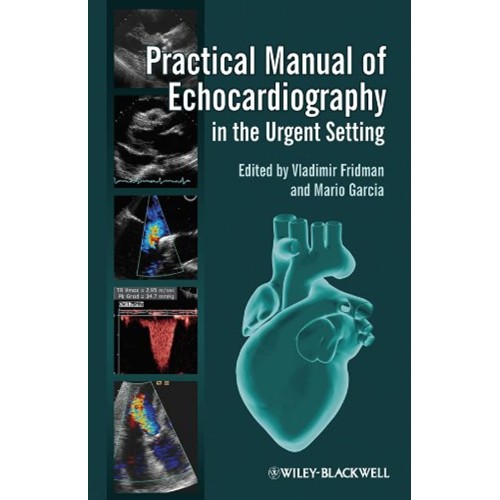 Practical Manual Of Echocardiography In The U...