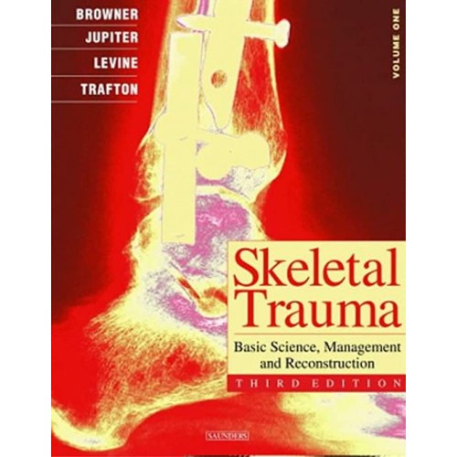 Skeletal Trauma Basic Science Management And ...