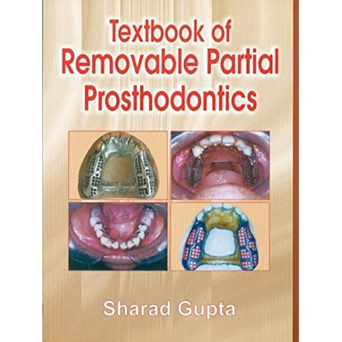 Textbook Of Removable Partial Prosthodontics ...