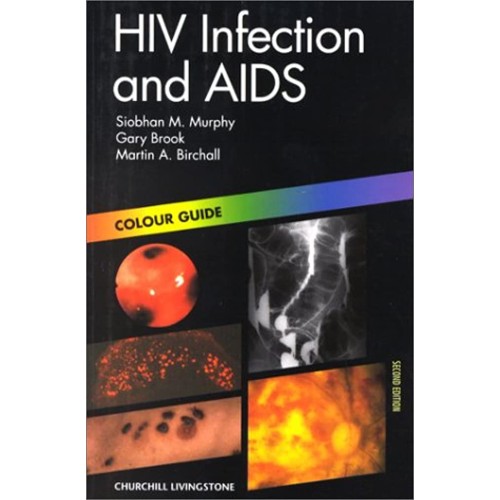 Hiv Infection And Aids Colour Guide (Pb 2000)