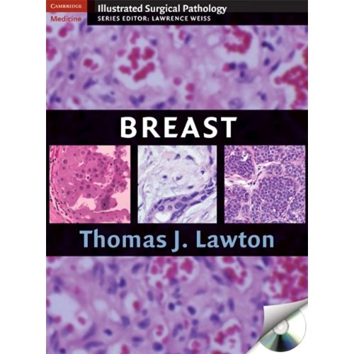 Breast (Hb 2009) 