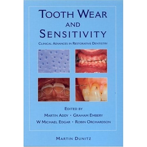 Tooth Wear And Sensitivity : Clinical Advance...