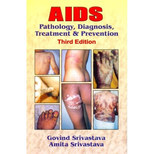 Aids Pathology Diagnosis Treatment And Preven...