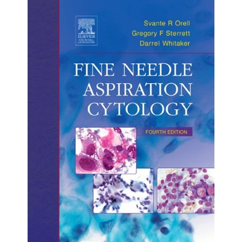 Fine Needle Aspiration Cytology, 4E (2005) 