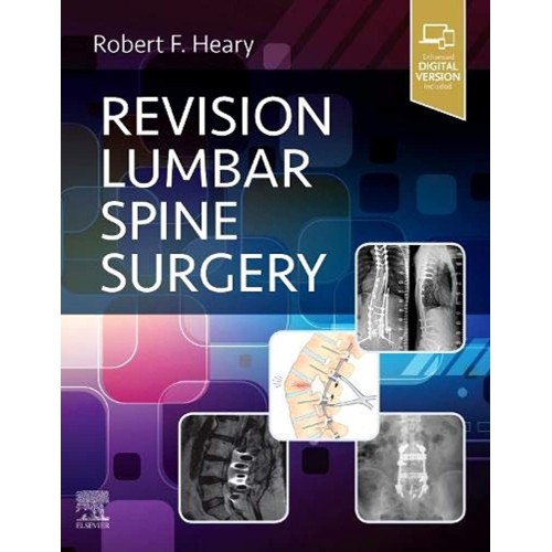 Revision Lumbar Spine Surgery (Hb 2022)