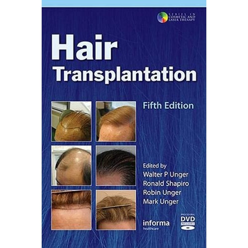 Hair Transplantation 5Ed (Hb 2011) 