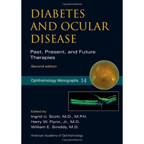 Diabetes And Ocular Disease Past Present And ...