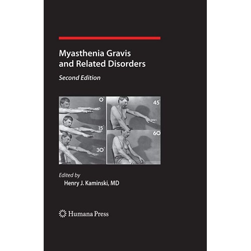 Myasthenia Gravis And Related Disorders 2Ed (...