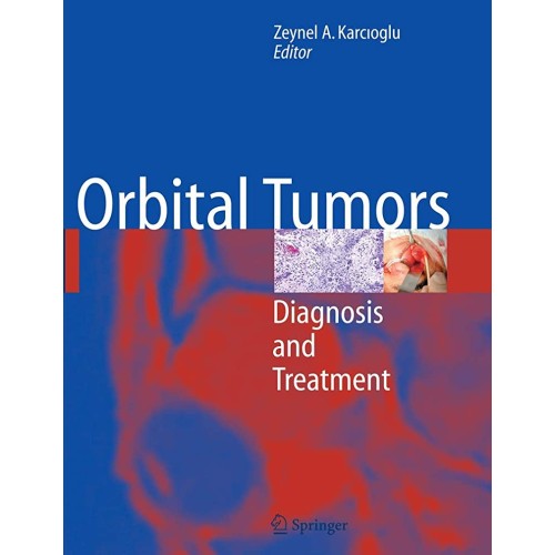 Orbital Tumors 