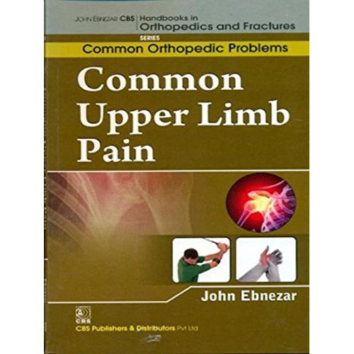 Common Upper Limb Pain (Handbooks Of Orthoped...