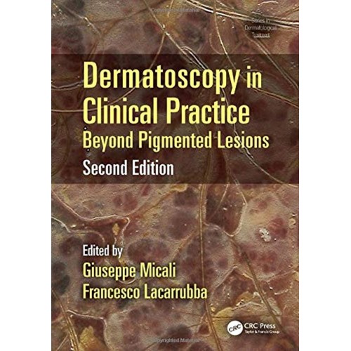 Dermatoscopy In Clinical Practice Beyond Pigm...