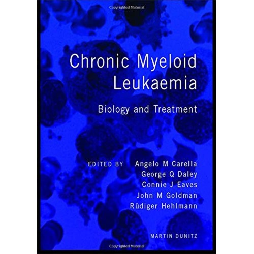 Chronic Myeloid Leukemia: Biology And Treatme...