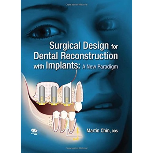 Surgical Design For Dental Reconstruction Wit...