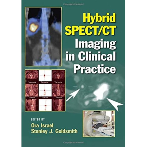 Hybrid Spect Ct Imaging In Clinical Practice 